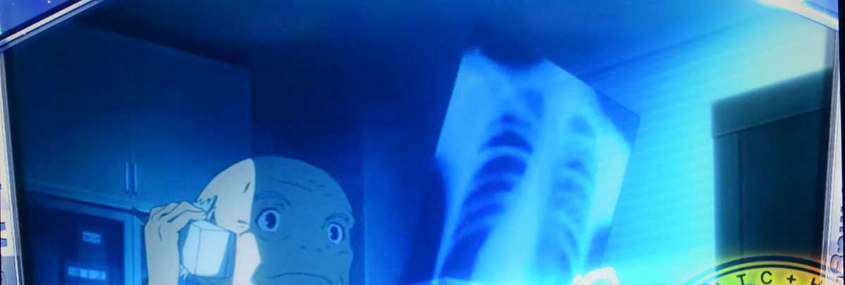 スマスロ とある魔術の禁書目録2　AT終了画面　カエル顔の医者
